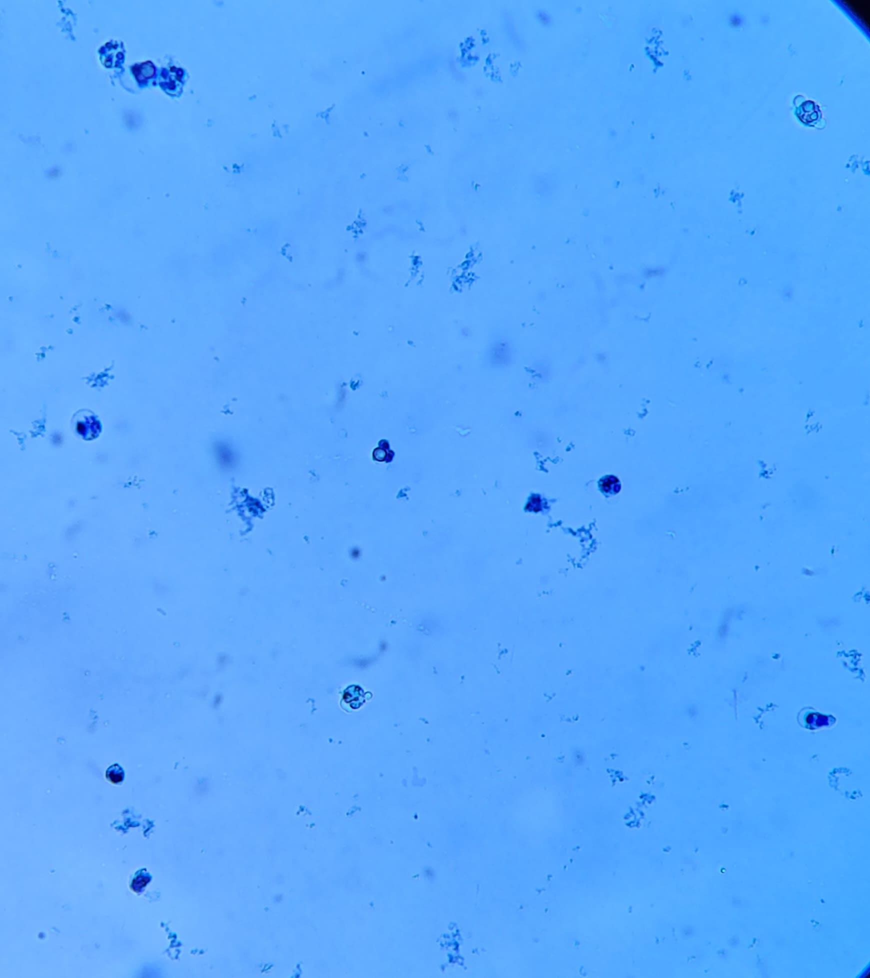 25. Somatic Cells From Milk